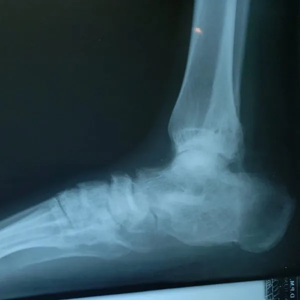 Sports Medicine and Trauma