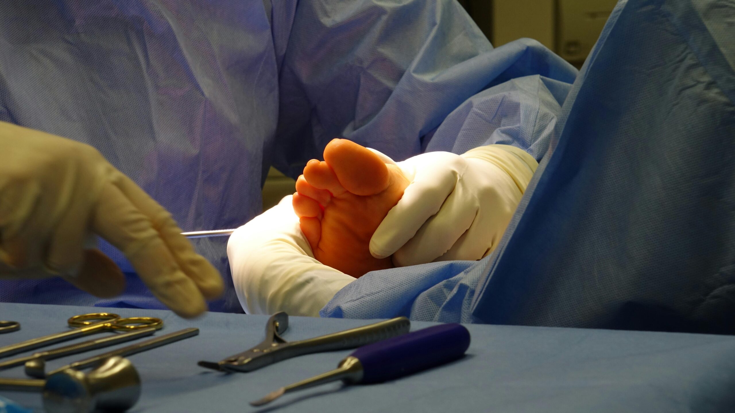ingrown toenail pompano beach