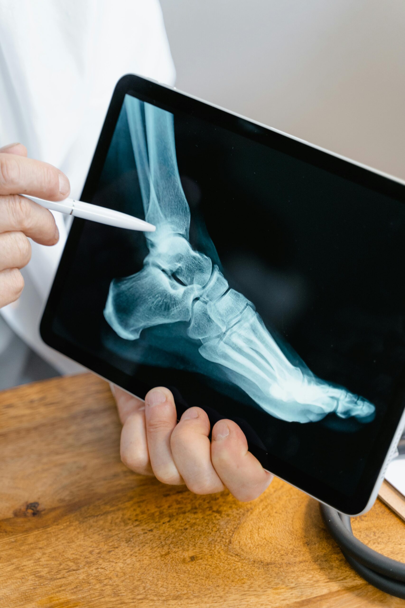 foot xray pompano beach